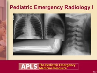 Pediatric Emergency Radiology I 