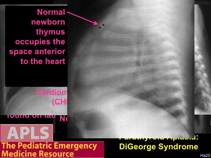 Apls Pediatric Emergency Radiology 1