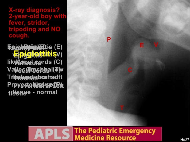 Apls Pediatric Emergency Radiology 1