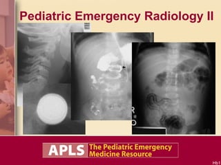 Pediatric Emergency Radiology II 