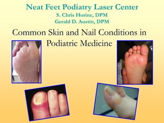 Common Skin and Nail Conditions in
Podiatric Medicine
Neat Feet Podiatry Laser Center
S. Chris Horine, DPM
Gerald D. Austin, DPM
 
