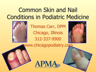 Common Skin and Nail Conditions in Podiatric Medicine ,[object Object],[object Object],[object Object],[object Object]
