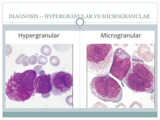 Acute Promyelocytic Leukemia (APML) .pptx