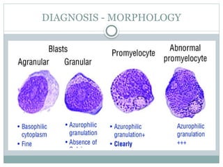 Acute Promyelocytic Leukemia (APML) .pptx
