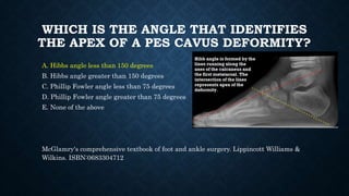 WHICH IS THE ANGLE THAT IDENTIFIES
THE APEX OF A PES CAVUS DEFORMITY?
A. Hibbs angle less than 150 degrees
B. Hibbs angle greater than 150 degrees
C. Phillip Fowler angle less than 75 degrees
D. Phillip Fowler angle greater than 75 degrees
E. None of the above
McGlamry's comprehensive textbook of foot and ankle surgery. Lippincott Williams &
Wilkins. ISBN:0683304712
 