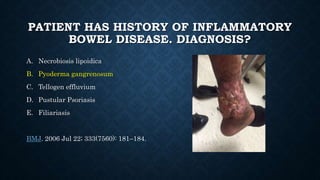 PATIENT HAS HISTORY OF INFLAMMATORY
BOWEL DISEASE. DIAGNOSIS?
A. Necrobiosis lipoidica
B. Pyoderma gangrenosum
C. Tellogen effluvium
D. Pustular Psoriasis
E. Filiariasis
BMJ. 2006 Jul 22; 333(7560): 181–184.
 