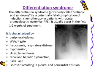 View of Acute Promyelocytic Leukaemia | PPTX