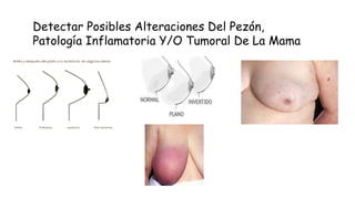 Detectar Posibles Alteraciones Del Pezón,
Patología Inflamatoria Y/O Tumoral De La Mama
 