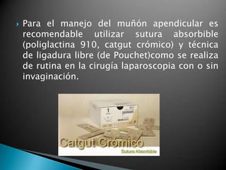    Para el manejo del muñón apendicular es
    recomendable utilizar sutura absorbible
    (poliglactina 910, catgut crómico) y técnica
    de ligadura libre (de Pouchet)como se realiza
    de rutina en la cirugía laparoscopia con o sin
    invaginación.
 