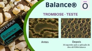 Balance®
TROMBOSE - TESTE
 