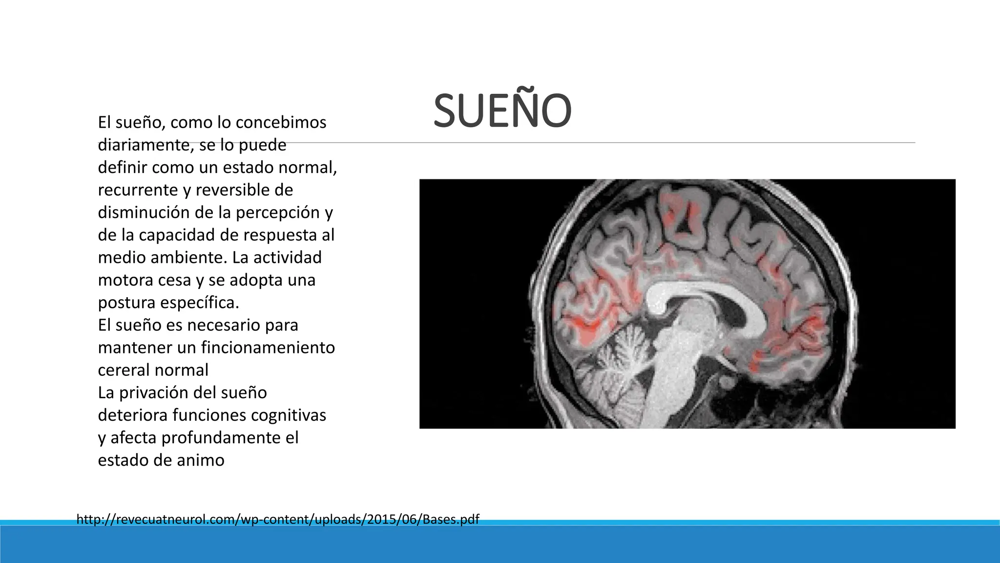 Sahos Machine Cpap sindrome de apnea e hipoapnea (sahos) presentacion | PPTX | Sleep ...