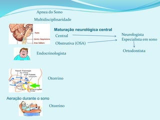 Apnea do Sono
Multidisciplinaridade
Otorrino
Endocrinologista
Maturação neurológica central
Central
Aeração durante o sono
Otorrino
Obstrutiva (OSA)
Ortodontista
Neurologista
Especialista em sono
 