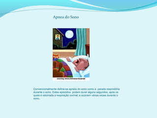 Convencionalmente define-se apnéia do sono como a parada respiratória
durante o sono. Estes episódios podem durar alguns segundos, após os
quais é retomada a respiração normal, e ocorrem várias vezes durante o
sono.
Apnea do Sono
 