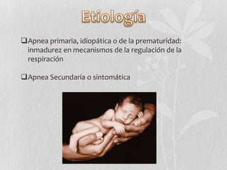 Apnea primaria, idiopática o de la prematuridad:
inmadurez en mecanismos de la regulación de la
respiración
Apnea Secund...