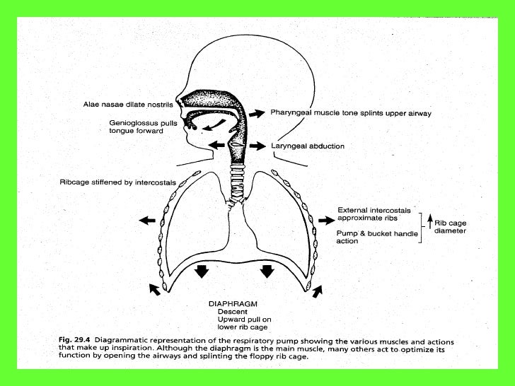 Apneaof prematurity detailedt