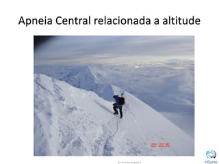 Apneia Central relacionada a altitude
 