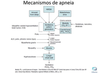 Mecanismos de apneia
 