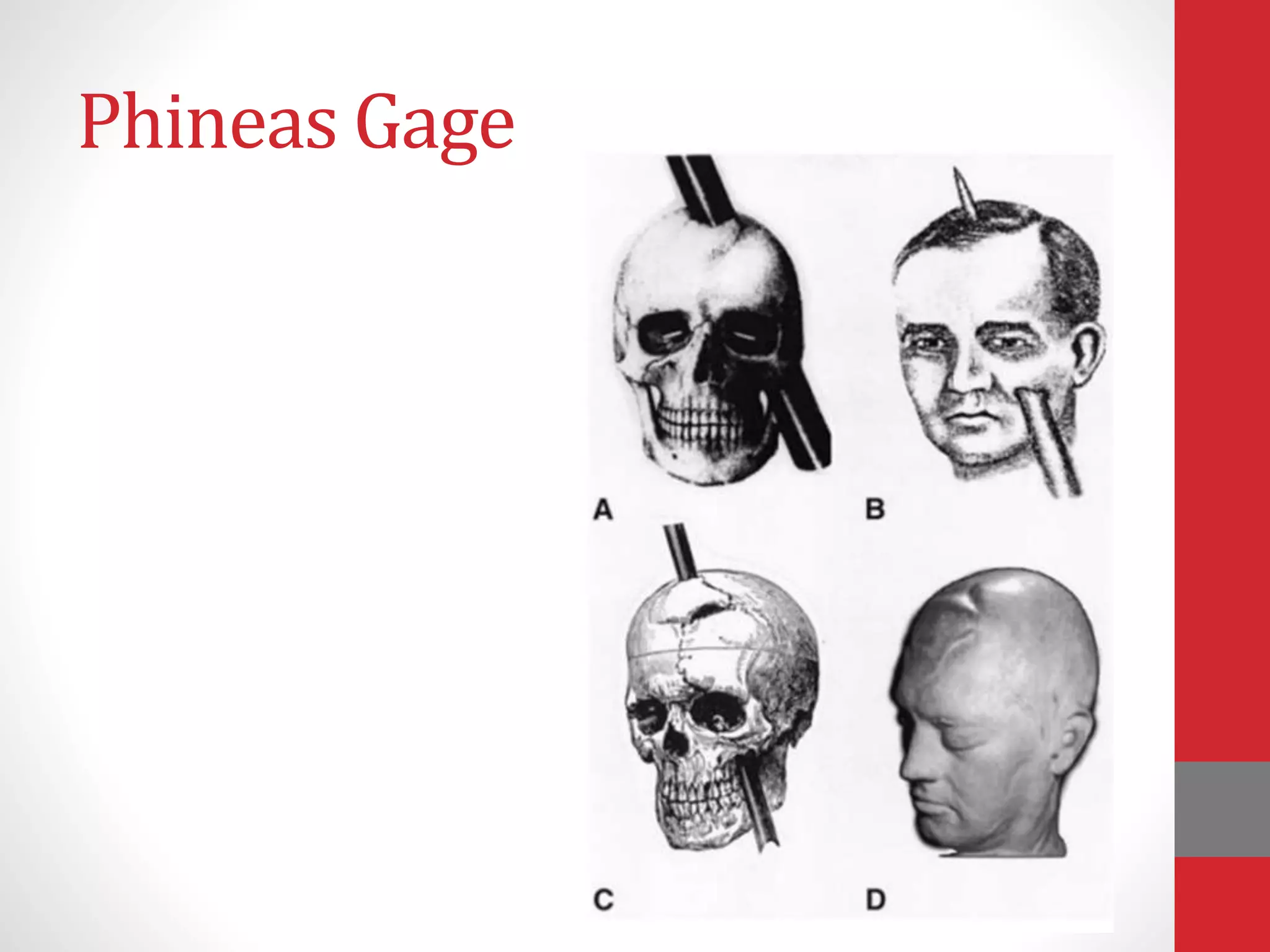 Phineas Gage
 