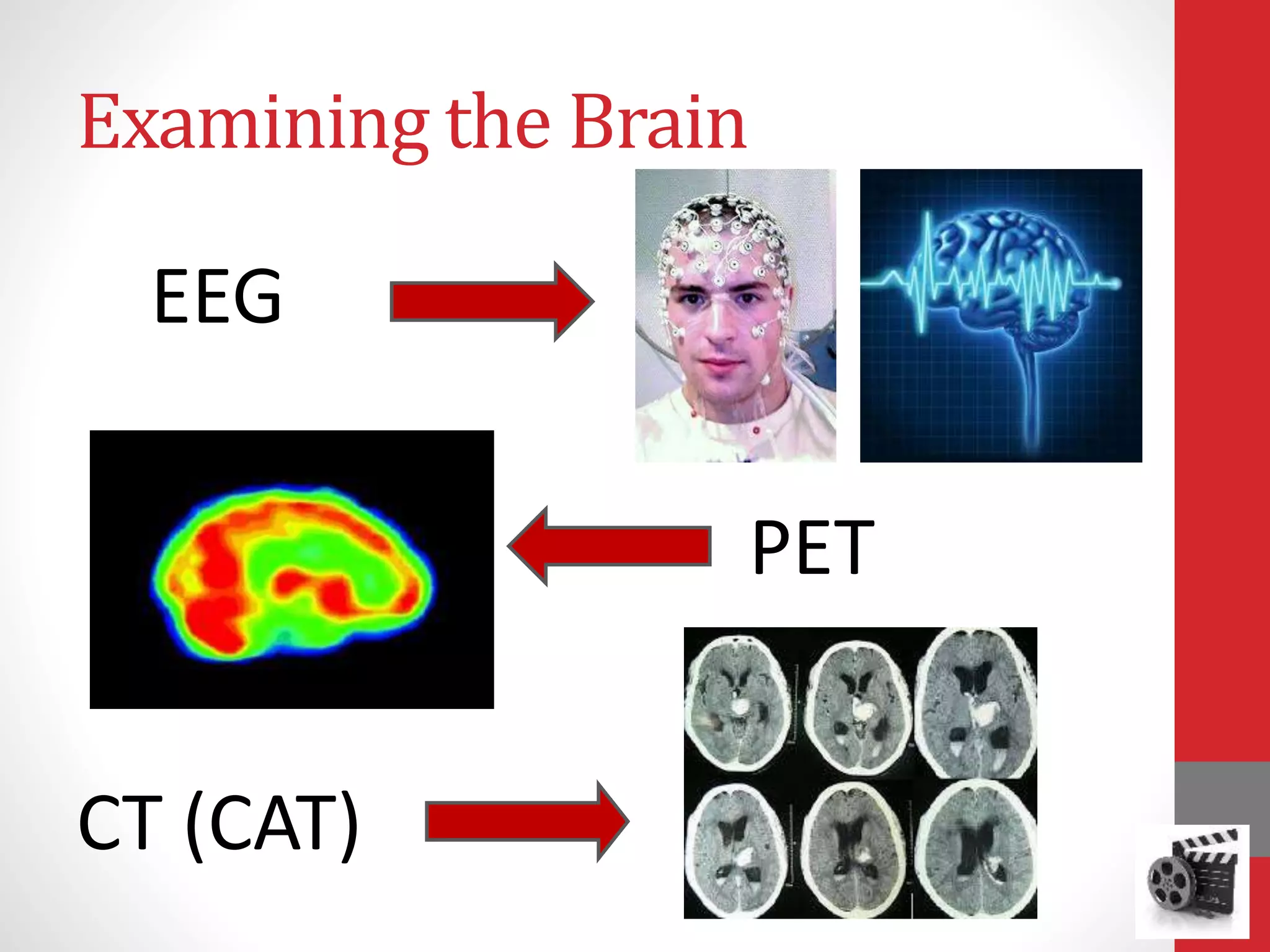 Examining the Brain
EEG
CT (CAT)
PET
 