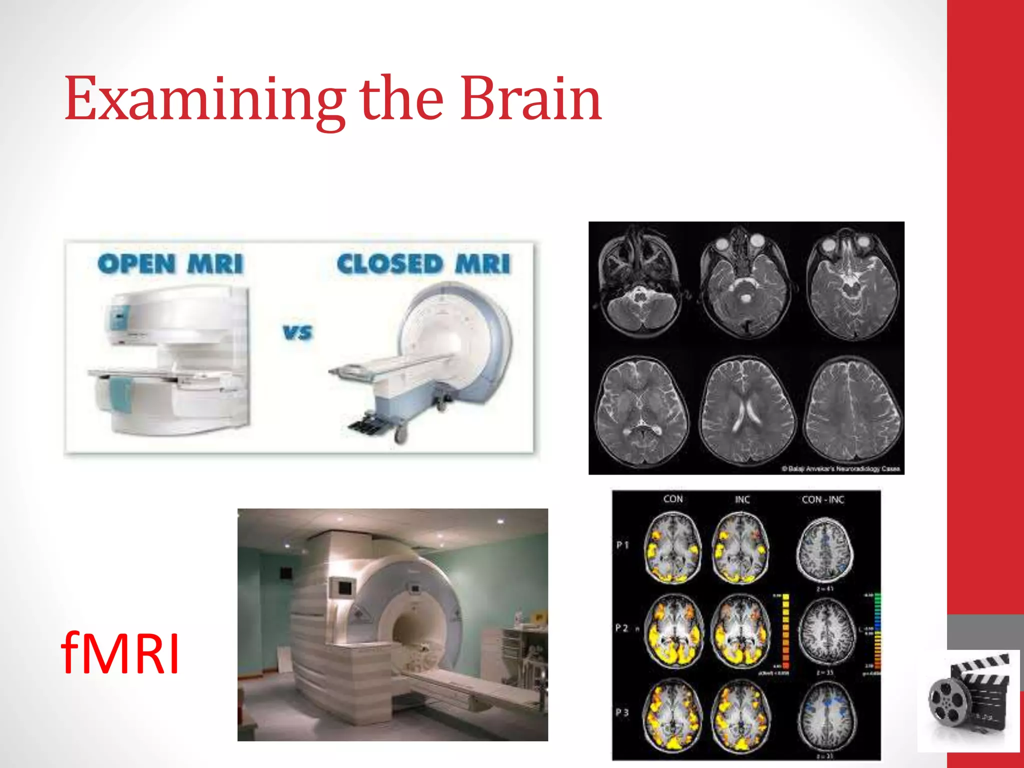 Examining the Brain
fMRI
 