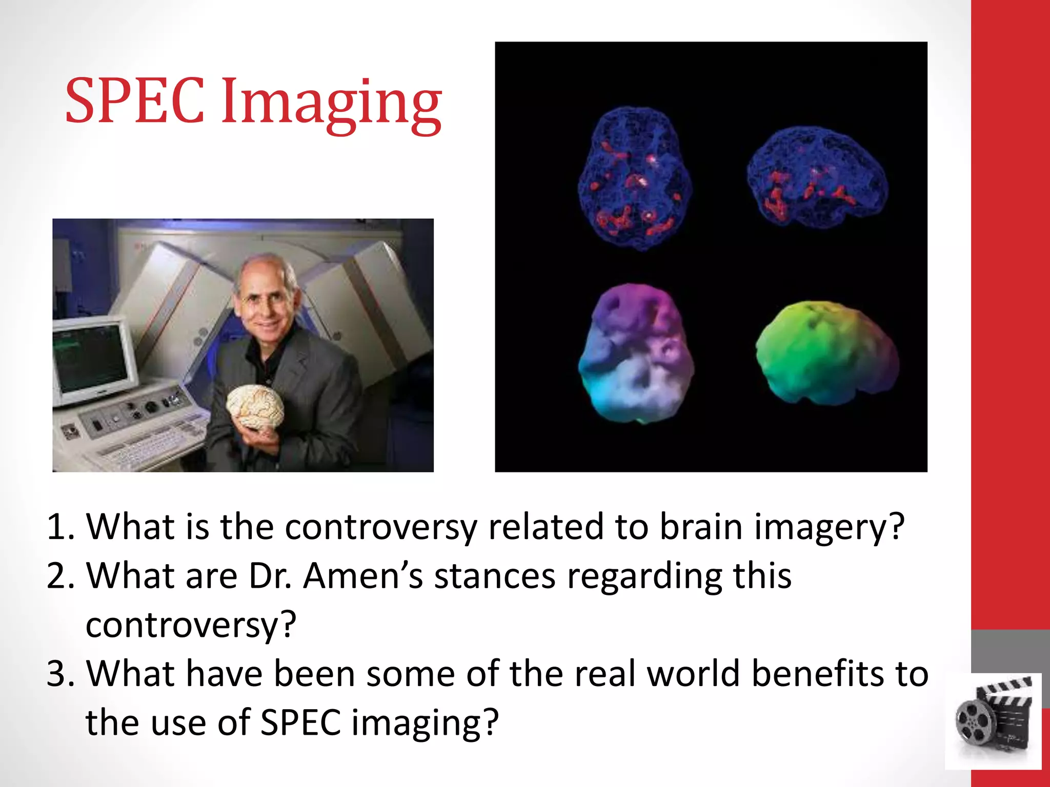 SPEC Imaging
1. What is the controversy related to brain imagery?
2. What are Dr. Amen’s stances regarding this
controversy?
3. What have been some of the real world benefits to
the use of SPEC imaging?
 