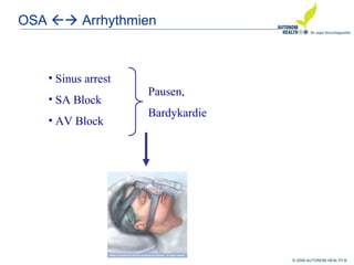 © 2008 AUTONOM HEALTH ®
OSA  Arrhythmien
• Sinus arrest
• SA Block
• AV Block
Pausen,
Bardykardie
 