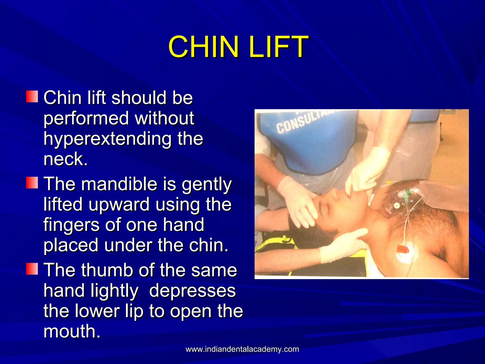 CHIN LIFT
Chin lift should be
performed without
hyperextending the
neck.
The mandible is gently
lifted upward using the
fingers of one hand
placed under the chin.
The thumb of the same
hand lightly depresses
the lower lip to open the
mouth.
www.indiandentalacademy.com

 