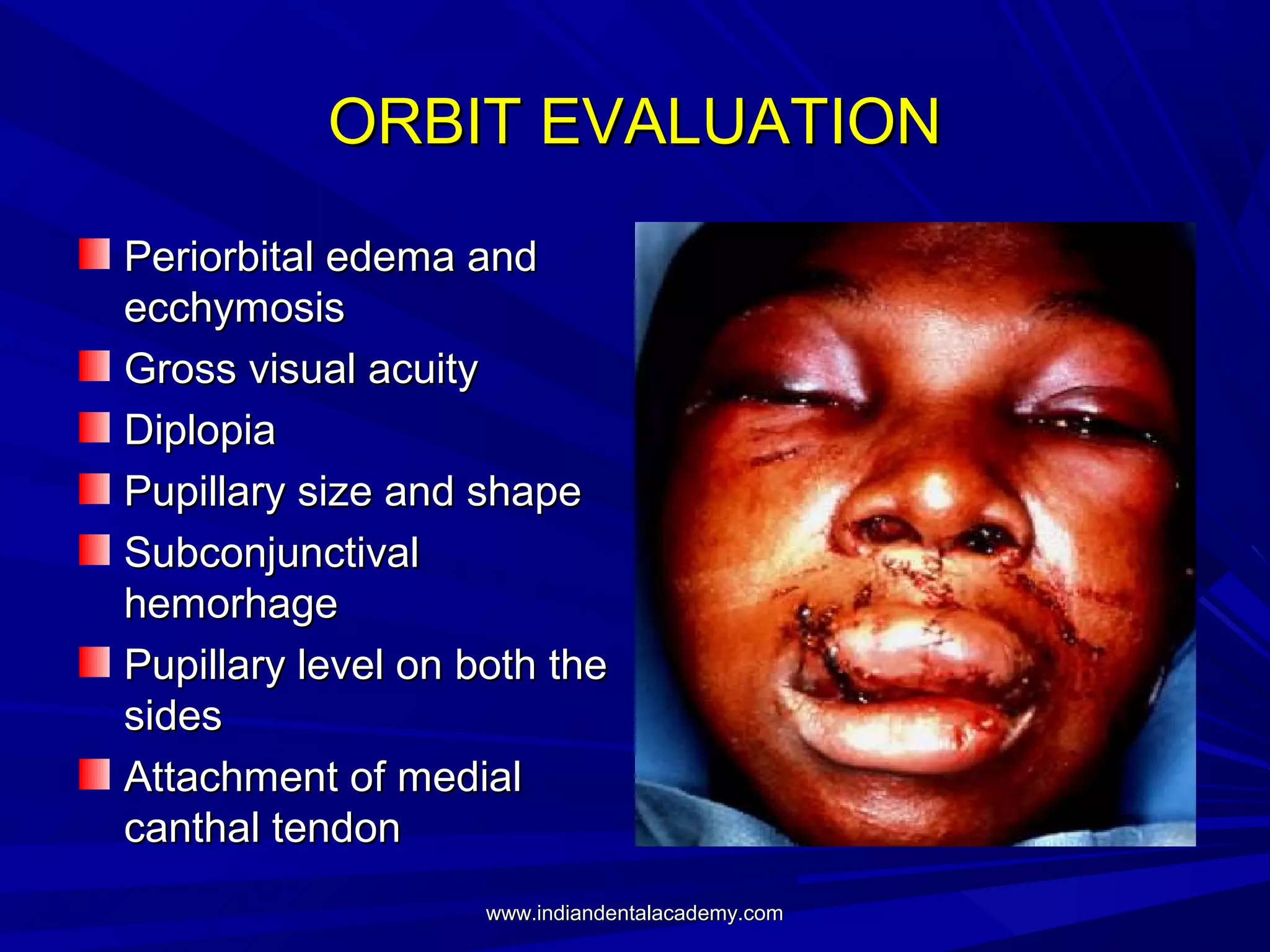 ORBIT EVALUATION
Periorbital edema and
ecchymosis
Gross visual acuity
Diplopia
Pupillary size and shape
Subconjunctival
hemorhage
Pupillary level on both the
sides
Attachment of medial
canthal tendon
www.indiandentalacademy.com

 