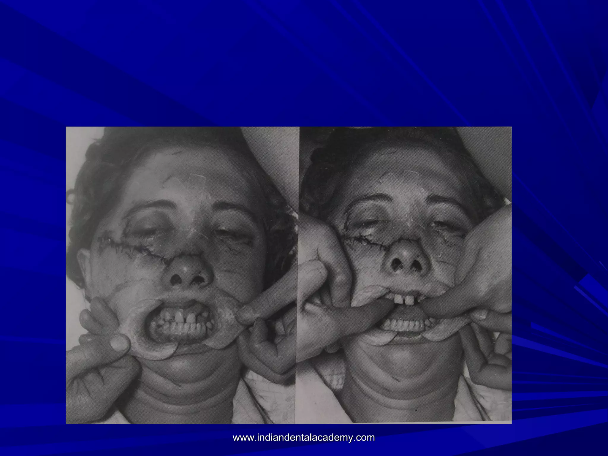 www.indiandentalacademy.com

 