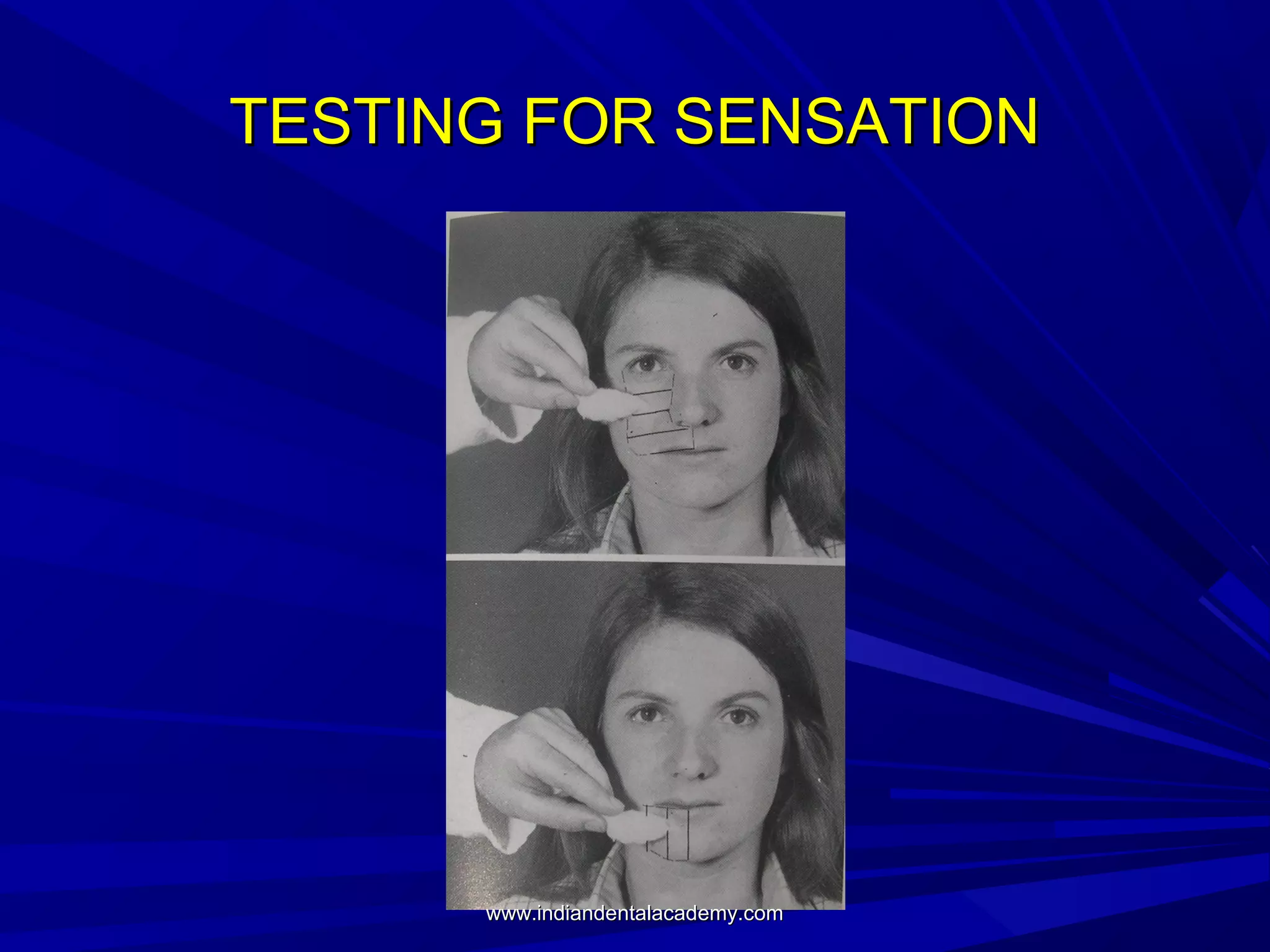 TESTING FOR SENSATION

www.indiandentalacademy.com

 