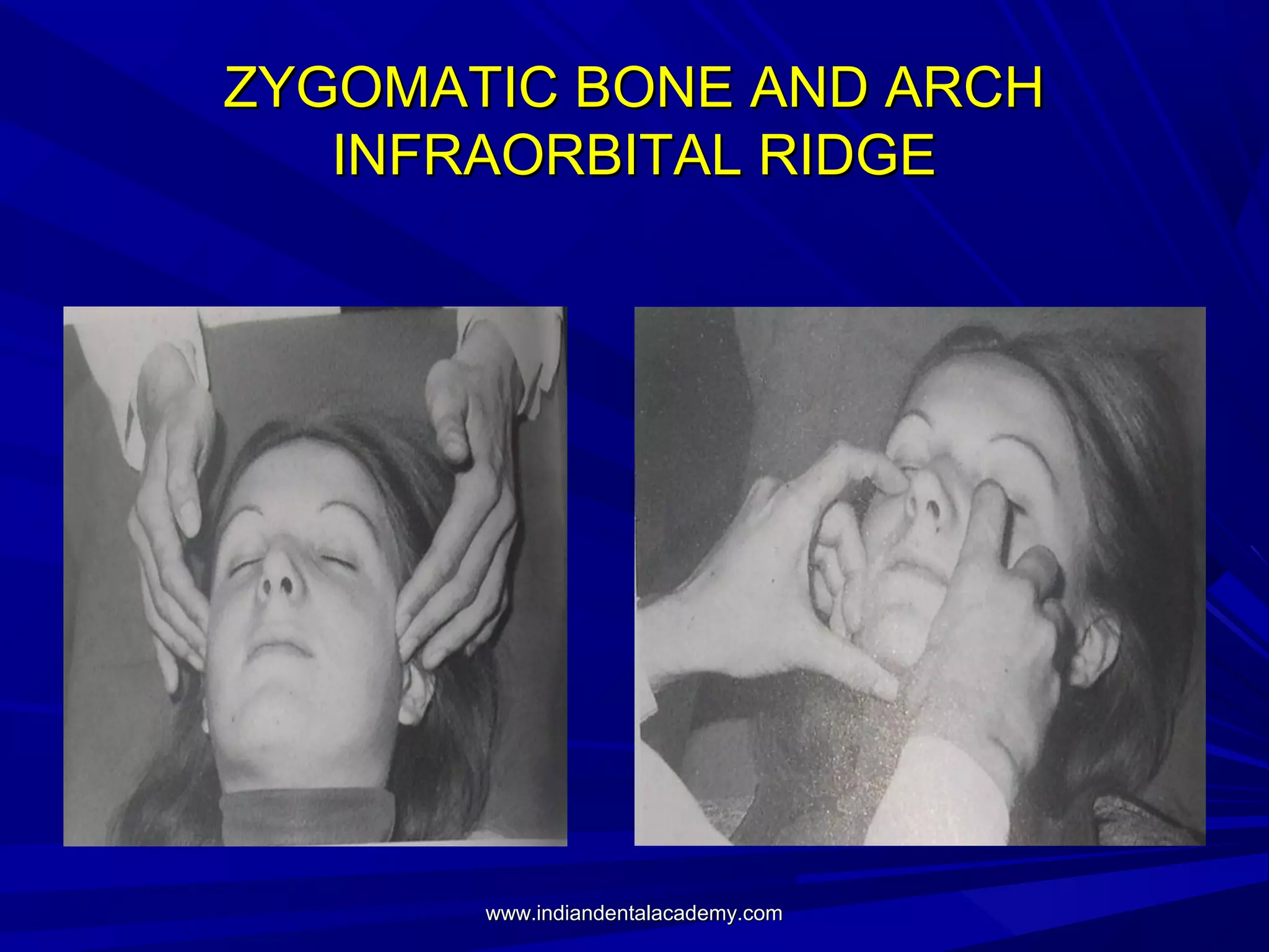 ZYGOMATIC BONE AND ARCH
INFRAORBITAL RIDGE

www.indiandentalacademy.com

 