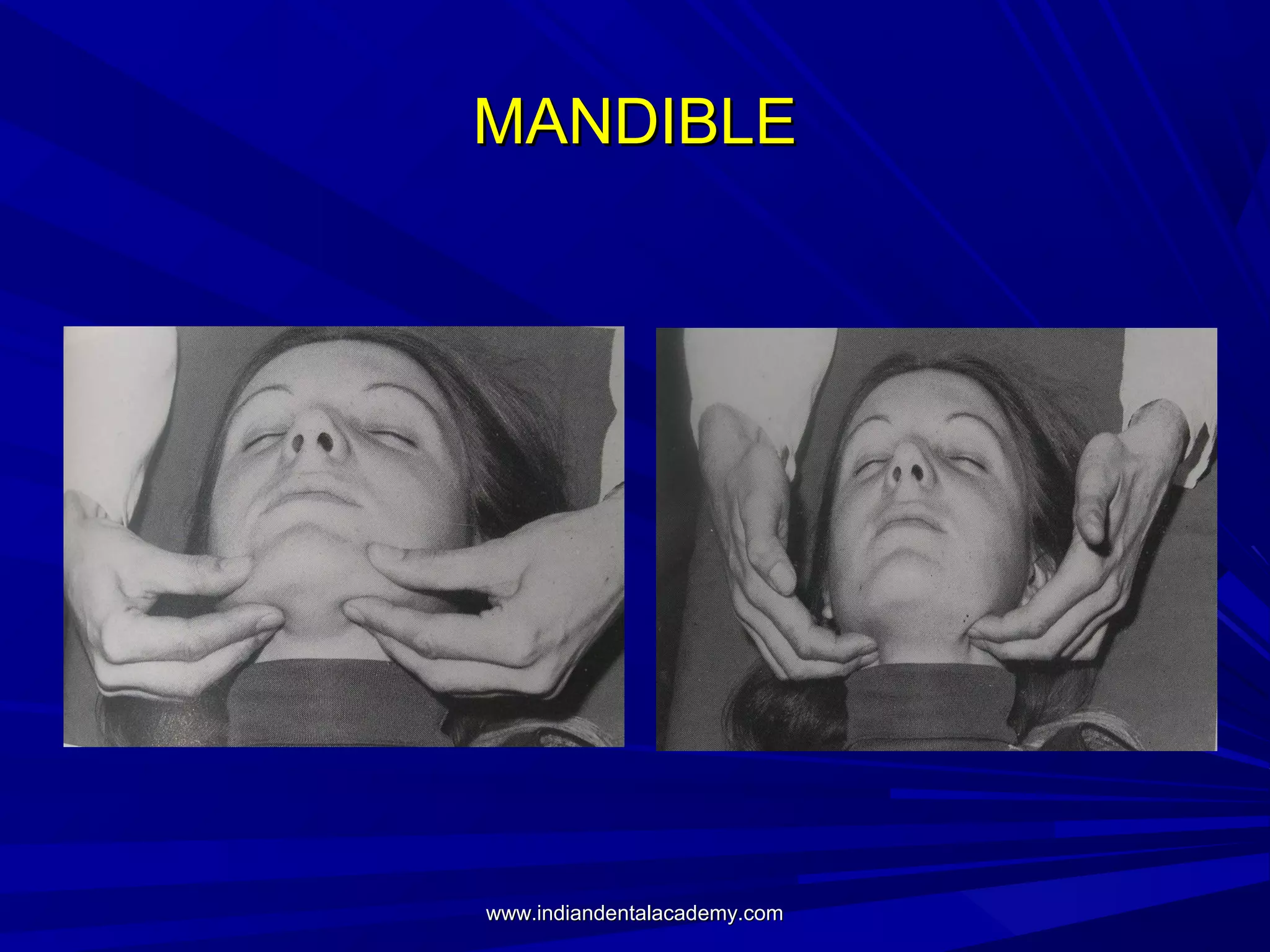 MANDIBLE

www.indiandentalacademy.com

 