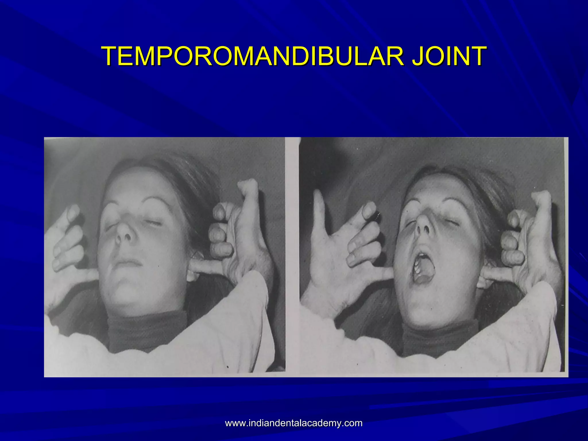 TEMPOROMANDIBULAR JOINT

www.indiandentalacademy.com

 