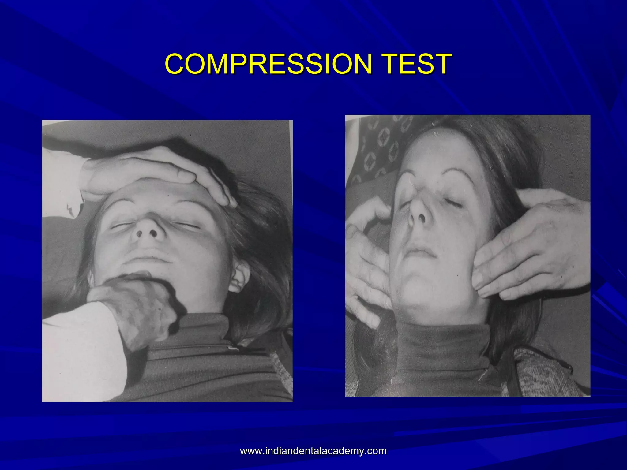 COMPRESSION TEST

www.indiandentalacademy.com

 