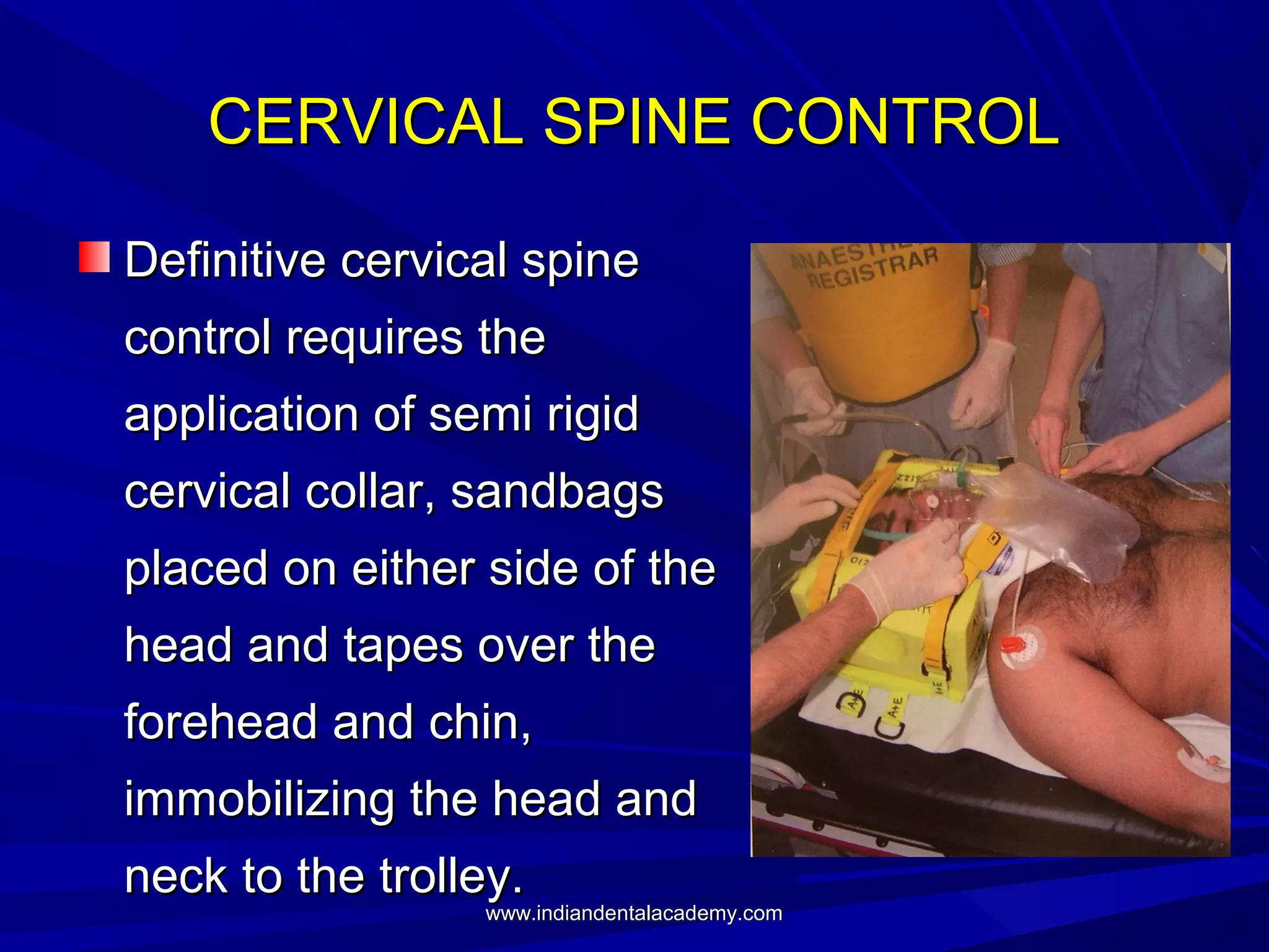 CERVICAL SPINE CONTROL
Definitive cervical spine
control requires the
application of semi rigid
cervical collar, sandbags
placed on either side of the
head and tapes over the
forehead and chin,
immobilizing the head and
neck to the trolley.

www.indiandentalacademy.com

 