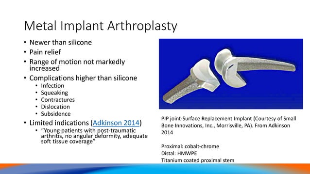 PIPJ Post-traumatic Arthritis: Arthrodesis vs Arthroplasty | PDF