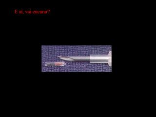 E aí, vai encarar? 