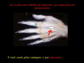 E você  usará, pelas vantagens  e  por  imposição ...  Já é usado como inibidor de sequestros  por empresários no mundo inteiro. 