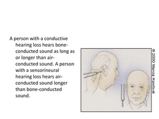 A person with a conductive
hearing loss hears boneconducted sound as long as
or longer than airconducted sound. A person
with a sensorineural
hearing loss hears airconducted sound longer
than bone-conducted
sound.

 