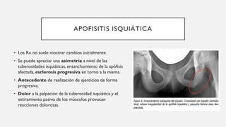 APOFISITIS ISQUIÁTICA
• Los Rx no suele mostrar cambios inicialmente.
• Se puede apreciar una asimetría a nivel de las
tuberosidades isquiáticas, ensanchamiento de la apófisis
afectada, esclerosis progresiva en torno a la misma.
• Antecedente de realización de ejercicios de forma
progresiva.
• Dolor a la palpación de la tuberosidad isquiática y el
estiramiento pasivo de los músculos provocan
reacciones dolorosas.
 