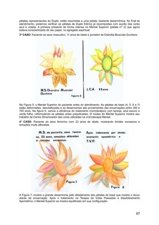pétalas representantes do Duplo, estão resumidas a uma pétala, bastante desarmônica. Ao final do
atendimento, podemos verificar as pétalas de Duplo Etérico já recompostas com auxílio das cores
azul e violeta. A primeira presente de forma intensa no Mental Superior (pétala n? 2) que agora
estava conscientizado de seu papel, no agregado espiritual.
3° CASO: Paciente do sexo masculino, 11 anos de idade e portador de Distrofia Muscular Duchene.
Na Figura 5, o Mental Superior do paciente antes do atendimento. As pétalas de base (4, 5, 6 e 7)
estão deformadas, desvitalizadas e as desarmonias são provenientes das encarnações entre 300 e
700 anos. Na figura 6, vemos a eficiência do tratamento cromoterápico com laranja, azul escuro e
verde folha, reformulando as pétalas antes prejudicadas. O núcleo do Mental Superior mostra seu
trabalho de Centro Dinamizador das cores utilizadas na cromoterapia Mental.
4° CASO: Paciente do sexo feminino com 23 anos de idade, mostrando timidez excessiva e
emoções muito afloradas.
A Figura 7, mostra a grande desarmonia pelo afastamento das pétalas de base que mostra o recuo
diante da encarnação. Após o tratamento na Terapia de Vidas Passadas e Desdobramento
Apométrico, o Mental Superior se mostra equilibrado em sua configuração.
67
 