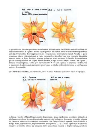 A paciente não retornou para outro atendimento. Mesmo assim verificou-se sensível melhora em
seu quadro clínico. A Figura 1 mostra a configuração do Mental, antes do atendimento apométrico
com desdobramento e dissociação dos níveis conscienciais e cromoterapia mental. Percebe-se que a
origem do câncer está relacionada a várias encarnações, fato observado pela coloração das pétala
das três almas. A figura do câncer aparece na base da pétala nuclear e é visível a desarmonia das
pétalas correspondentes aos corpos Mental Inferior, Corpo Astral e Duplo Etérico. Na Figura 2,
temos a configuração do Mental após o atendimento. A cor azul, segundo os orientais, é a ideal para
o tratamento do câncer, pois permanece envolvendo as pétalas onde anteriormente se verificava as
maiores desarmonias.
2o CASO: Paciente M.R., sexo feminino, idade 31 anos. Problema: constantes crises de Epilepsia.
A Figura 3 mostra o Mental Superior antes do primeiro e único atendimento apométrico efetuado. A
pétala correspondente à Alma Consciencial, detentora de lembranças de eventos ocorridos há mais
de 700 anos, mostra-se com extrema desarmonia. Nos Corpos Mental Superior, Mental Inferior e
Corpo Astral, representados, respectivamente, pelas pétalas 2, 3 e 4, existe a presença de obsessão
vingativa (vermelho intenso de fora para dentro das pétalas citadas). O Duplo Etérico, devido às
 