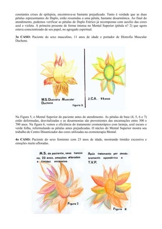 constantes crises de epilepsia, encontrava-se bastante prejudicado. Tanto é verdade que as duas
pétalas representantes do Duplo, estão resumidas a uma pétala, bastante desarmônica. Ao final do
atendimento, podemos verificar as pétalas de Duplo Etérico já recompostas com auxílio das cores
azul e violeta. A primeira presente de forma intensa no Mental Superior (pétala n? 2) que agora
estava conscientizado de seu papel, no agregado espiritual.
3o CASO: Paciente do sexo masculino, 11 anos de idade e portador de Distrofia Muscular
Duchene.
Na Figura 5, o Mental Superior do paciente antes do atendimento. As pétalas de base (4, 5, 6 e 7)
estão deformadas, desvitalizadas e as desarmonias são provenientes das encarnações entre 300 e
700 anos. Na figura 6, vemos a eficiência do tratamento cromoterápico com laranja, azul escuro e
verde folha, reformulando as pétalas antes prejudicadas. O núcleo do Mental Superior mostra seu
trabalho de Centro Dinamizador das cores utilizadas na cromoterapia Mental.
4o CASO: Paciente do sexo feminino com 23 anos de idade, mostrando timidez excessiva e
emoções muito afloradas.
 