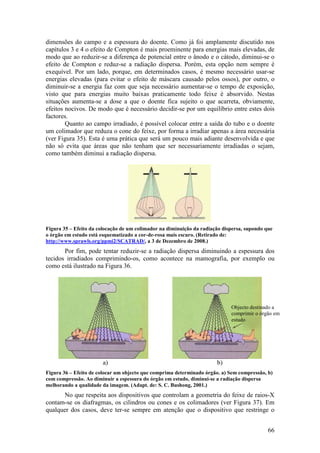 dimensões do campo e a espessura do doente. Como já foi amplamente discutido nos
capítulos 3 e 4 o efeito de Compton é mais proeminente para energias mais elevadas, de
modo que ao reduzir-se a diferença de potencial entre o ânodo e o cátodo, diminui-se o
efeito de Compton e reduz-se a radiação dispersa. Porém, esta opção nem sempre é
exequível. Por um lado, porque, em determinados casos, é mesmo necessário usar-se
energias elevadas (para evitar o efeito de máscara causado pelos ossos), por outro, o
diminuir-se a energia faz com que seja necessário aumentar-se o tempo de exposição,
visto que para energias muito baixas praticamente todo feixe é absorvido. Nestas
situações aumenta-se a dose a que o doente fica sujeito o que acarreta, obviamente,
efeitos nocivos. De modo que é necessário decidir-se por um equilíbrio entre estes dois
factores.
        Quanto ao campo irradiado, é possível colocar entre a saída do tubo e o doente
um colimador que reduza o cone do feixe, por forma a irradiar apenas a área necessária
(ver Figura 35). Esta é uma prática que será um pouco mais adiante desenvolvida e que
não só evita que áreas que não tenham que ser necessariamente irradiadas o sejam,
como também diminui a radiação dispersa.




Figura 35 – Efeito da colocação de um colimador na diminuição da radiação dispersa, supondo que
o órgão em estudo está esquematizado a cor-de-rosa mais escuro. (Retirado de:
http://www.sprawls.org/ppmi2/SCATRAD/, a 3 de Dezembro de 2008.)
       Por fim, pode tentar reduzir-se a radiação dispersa diminuindo a espessura dos
tecidos irradiados comprimindo-os, como acontece na mamografia, por exemplo ou
como está ilustrado na Figura 36.




                                                                             Objecto destinado a
                                                                             comprimir o órgão em
                                                                             estudo




                       a)                                              b)
Figura 36 – Efeito de colocar um objecto que comprima determinado órgão. a) Sem compressão, b)
com compressão. Ao diminuir a espessura do órgão em estudo, diminui-se a radiação dispersa
melhorando a qualidade da imagem. (Adapt. de: S. C. Bushong, 2001.)
       No que respeita aos dispositivos que controlam a geometria do feixe de raios-X
contam-se os diafragmas, os cilindros ou cones e os colimadores (ver Figura 37). Em
qualquer dos casos, deve ter-se sempre em atenção que o dispositivo que restringe o


                                                                                             66
 