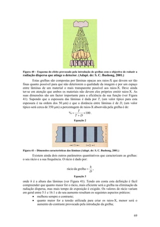 Figura 40 – Esquema do efeito provocado pela introdução de grelhas com o objectivo de reduzir a
radiação dispersa que atinge o detector. (Adapt. de: S. C. Bushong, 2001.)
        Estas grelhas são compostas por lâminas opacas aos raios-X que devem ser tão
finas quanto possível para que não deteriorem a qualidade da imagem e por um espaço
entre lâminas de um material o mais transparente possível aos raios-X. Deve ainda
ter-se em atenção que ambos os materiais não devem eles próprios emitir raios-X. As
suas dimensões são um factor importante para a eficiência da sua função (ver Figura
41). Supondo que a espessura das lâminas é dada por T, (um valor típico para esta
espessura é na ordem dos 50 µm) e que a distância entre lâminas é de D, (um valor
típico será cerca de 350 µm) a percentagem de raios-X absorvida pela grelha é de:
                                          T
                                    %=        × 100 .
                                        T+D
                                            Equação 2




Figura 41 – Dimensões características das lâminas (Adapt. de: S. C. Bushong, 2001.)
        Existem ainda dois outros parâmetros quantitativos que caracterizam as grelhas:
o seu rácio e a sua frequência. O rácio é dado por:

                                                         h
                                     rácio da grelha =     ,
                                                         D
                                            Equação 3
onde h é a altura das lâminas (ver Figura 41). Tendo em conta esta definição é fácil
compreender que quanto maior for o rácio, mais eficiente será a grelha na eliminação da
radiação dispersa, mas mais tempo de exposição é exigido. Os valores de rácio variam
em geral entre 5:1 e 16:1 e do seu aumento resultam os seguintes aspectos práticos:
       • melhora sempre o contraste;
       • quanto maior for a tensão utilizada para criar os raios-X, menor será o
           aumento do contraste provocado pela introdução da grelha;


                                                                                            69
 