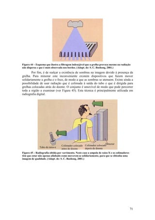 Figura 44 – Esquema que ilustra a filtragem indesejável que a grelha provoca mesmo na radiação
não dispersa e que é mais observada nos bordos. (Adapt. de: S. C. Bushong, 2001.)
        Por fim, é de realçar a existência de sombras na imagem devido à presença da
grelha. Para minorar este inconveniente existem dispositivos que fazem mover
solidariamente a grelha e o foco, de modo a que as sombras se atenuem. Existe ainda a
possibilidade de usar radiação que é colimada à saída do tubo e que é dirigida para
grelhas colocadas atrás do doente. O conjunto é amovível de modo que pode percorrer
toda a região a examinar (ver Figura 45). Esta técnica é principalmente utilizada em
radiografia digital.




                                                                      Detector
                                  Colimador colocado Colimador colocado
               Tubo de raios-x                       depois do doente
                                  antes do doente
Figura 45 – Radiografia obtida por varrimento. Neste caso a ampola de raios-X e os colimadores
têm que estar não apenas alinhado como moverem-se solidariamente, para que se obtenha uma
imagem de qualidade. (Adapt. de: S. C. Bushong, 2001.)




                                                                                                 71
 