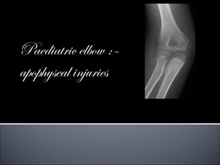 Paediatric elbow :–
apophyseal injuries
 