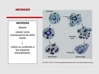 NECROSIS




    NECROSIS
       Muerte
    celular como
consecuencia de daño
       tisular


Libera su contenido a
    los espacios
   extracelulares


                        http://200.72.204.110/web/images/Biologia/Apoptosis/Ciclo%20de%20apoptosis.jpg
 