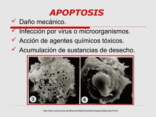 APOPTOSIS
   Daño mecánico.
   Infección por virus o microorganismos.
   Acción de agentes químicos tóxicos.
   Acumulación de sustancias de desecho.




           http://www.cyto.purdue.edu/flowcyt/research/cytotech/apopto/data/chap10.htm
 