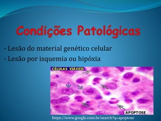 - Lesão do material genético celular
- Lesão por isquemia ou hipóxia
https://www.google.com.br/search?q=apoptose
 